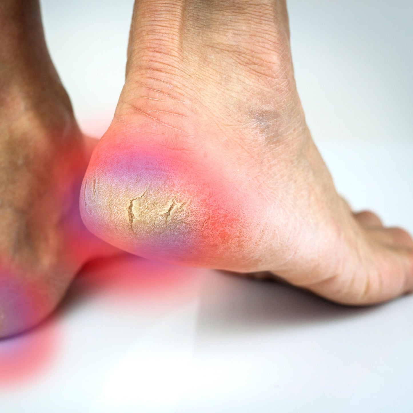 Remove gap - partial treatment max 15min