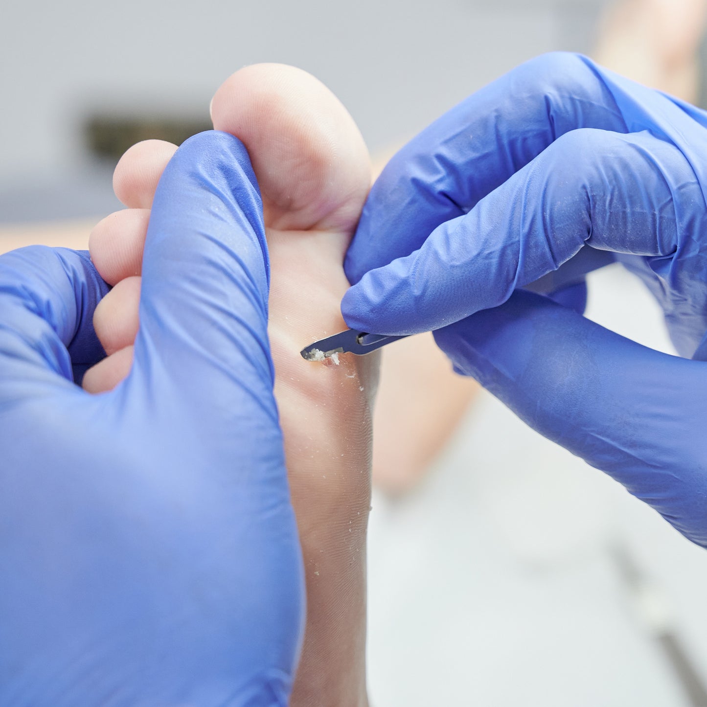 Pedicure treatment max 30 min