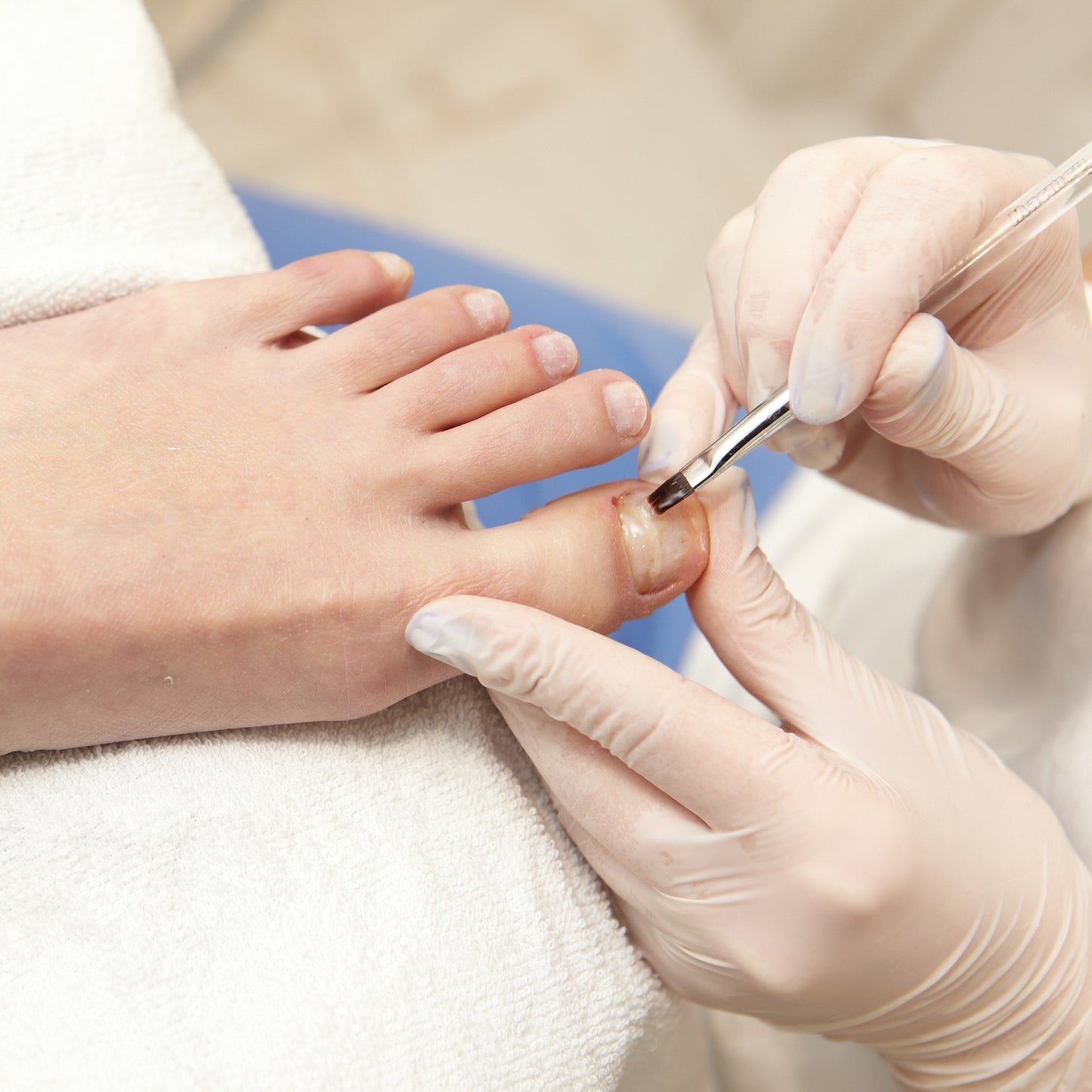 Pedicure voert nagelreparatie uit met gel techniek